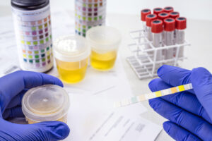 cocaine-drug-testing